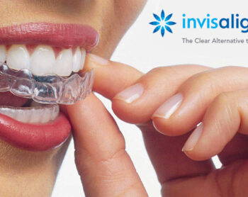 Invisalign ortodonzia estetica